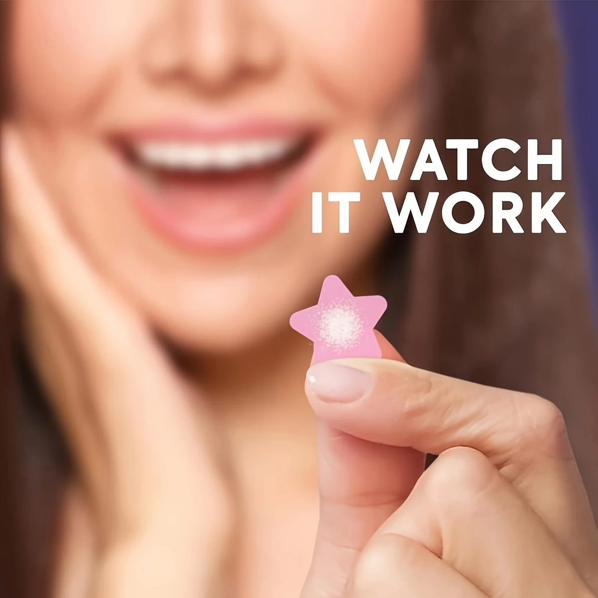 Star-Shaped Hydrocolloid Pimple Patches (240 Pack)